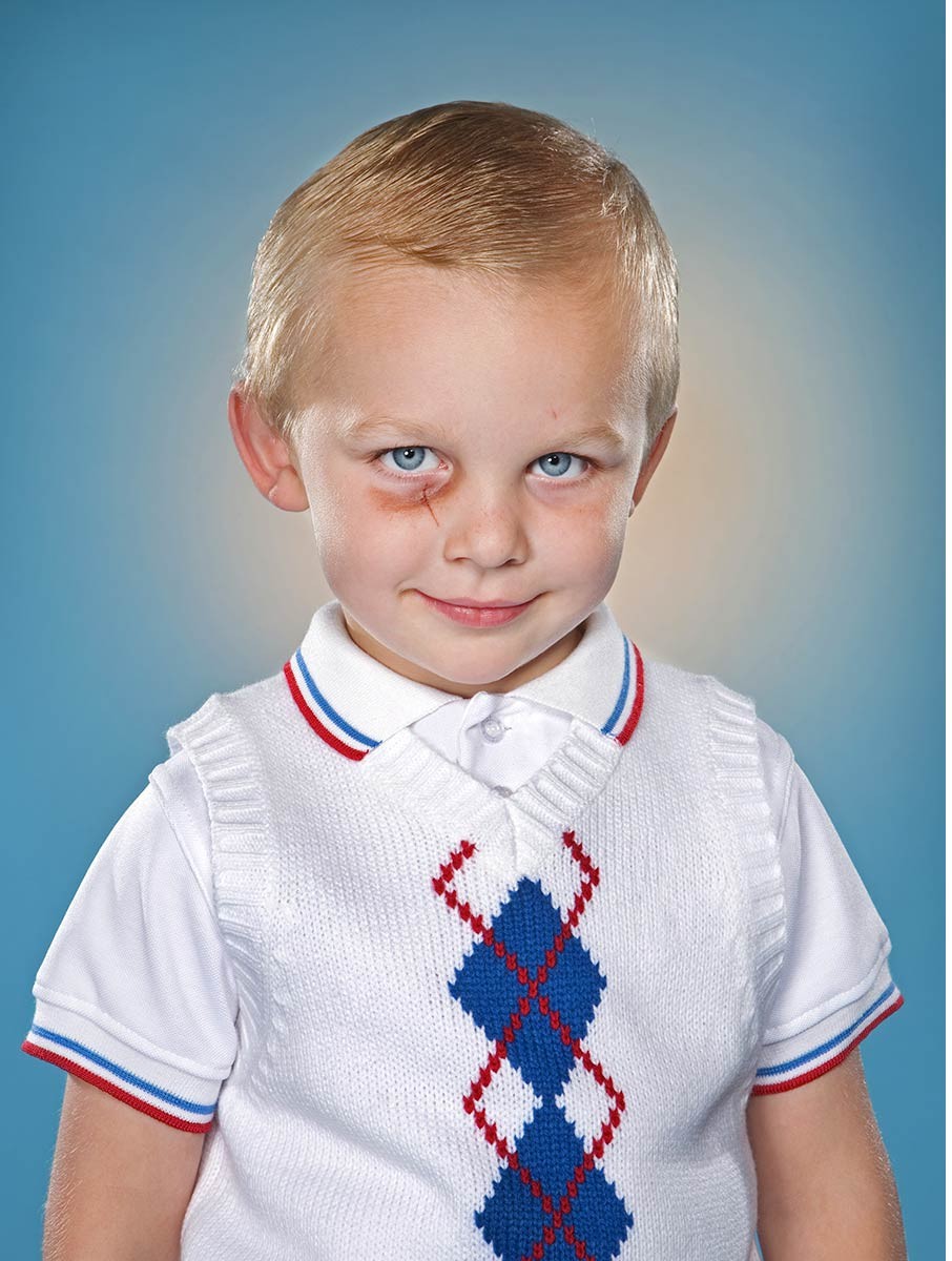 06advertisingkidphotographerportraitbruisefunny